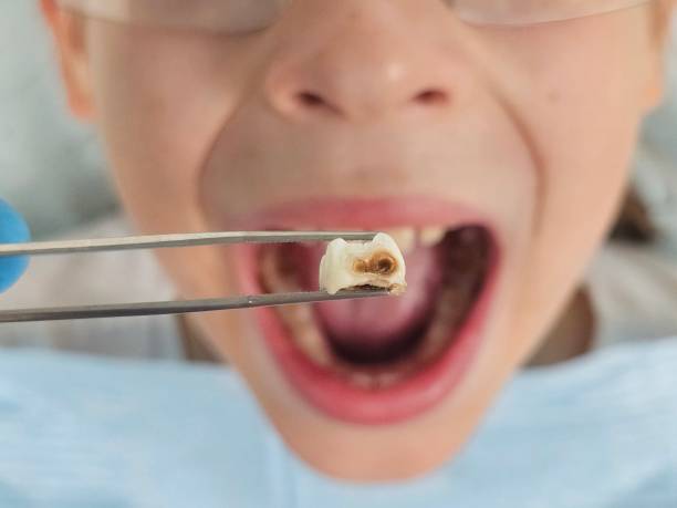 Best Tooth Pain Emergency Relief  in Pulaski, VA